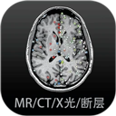 我秀